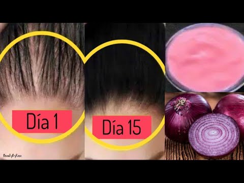 Beneficios del champú de cebolla de Mi Rebotica para fortalecer y revitalizar tu cabello